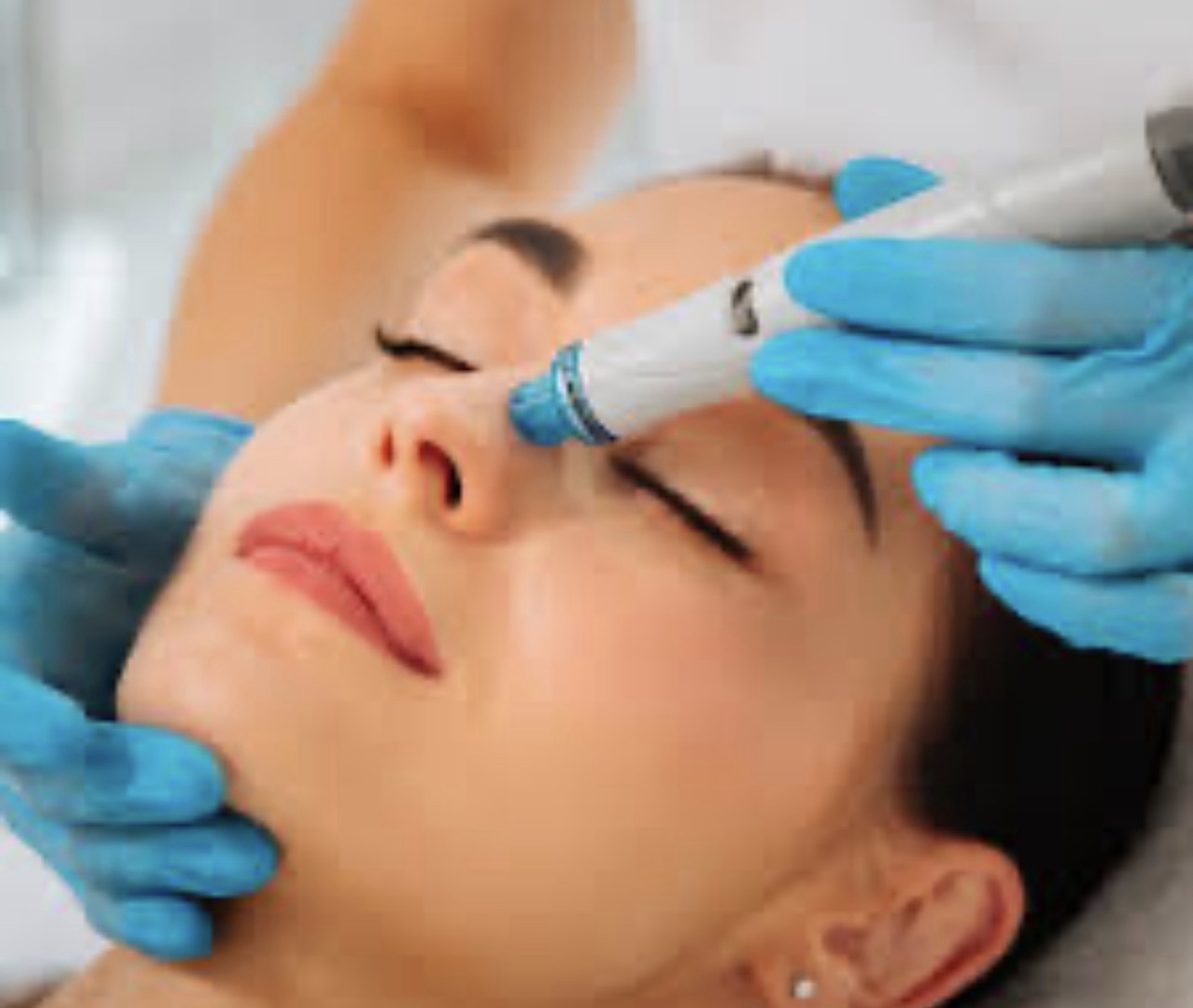 PULIZIA PROFONDA HYDRASKIN - immagine 2